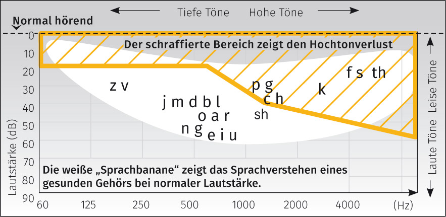 Sprachbanane
